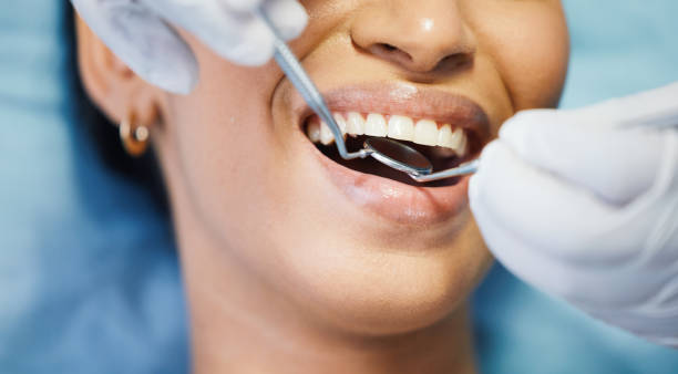 Best Knocked-Out Tooth (Avulsed Tooth) Treatment in Coal Run Village, KY