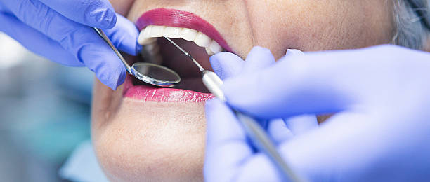 Best Broken or Chipped Tooth Repair in Coal Run Village, KY